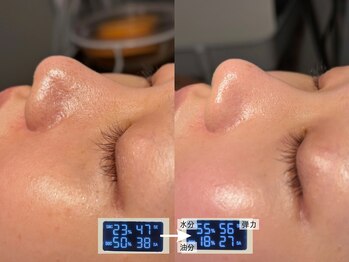 ルーナジェーナ(Luna llena)/池袋 エステ ルーナジェーナ