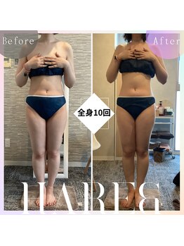 ハレアンド(Hare&)/30代全身10回目Before After