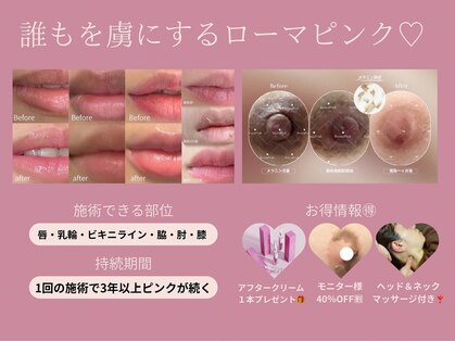 リラクゼーション つぼみの写真