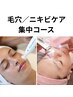 《毛穴×ニキビケア》最新プラズママシーン導入&ピーリングで毛穴引き締め