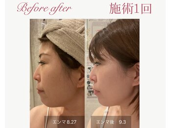 パルタージュ 三宮(Partage)/オーダーメイドプログラム★