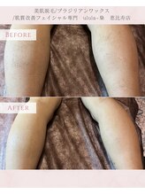 ウルラ 梟(ulula 梟)/ふくらはぎ脱毛♪