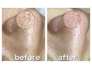 ビジュツ(BIJYUTSU)/