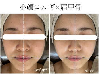 ラフェリ(Rafeli)/小顔コルギ＋肩甲骨ほぐし