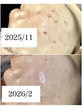 ブラックボックス(BLACK BOX)/10代女性のお客様