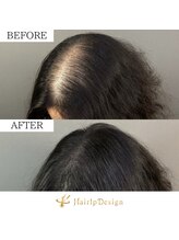 アボット キニー(Abbot Kinney)/