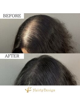 アボット キニー(Abbot Kinney)/