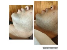 獅子の褒美の雰囲気（メンズ脱毛を種類豊富にご用意！）
