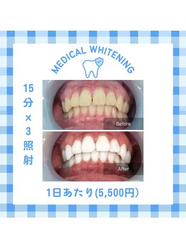 ベルプラス 新大阪(Belle plus)/Belle plus ホワイトニング