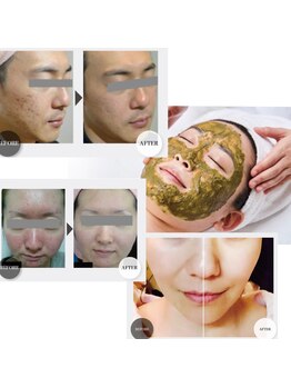 スタイリッシュビューティー(stylish beauty)/当サロン人気メニューNO.1パック