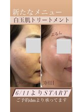 リノ(Lino)/白玉肌トリートメント