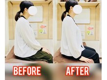 はぴねす鍼灸整骨院 西宮院/施術前後の写真です