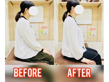 はぴねす鍼灸整骨院 西宮院/施術前後の写真です