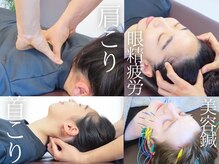 エイト鍼灸 整骨院 表参道(8eight鍼灸 整骨院)