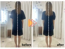 ラフィング(Laughing)/産後骨盤矯正