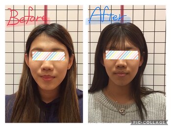 堺整骨院 小郡院/小顔矯正