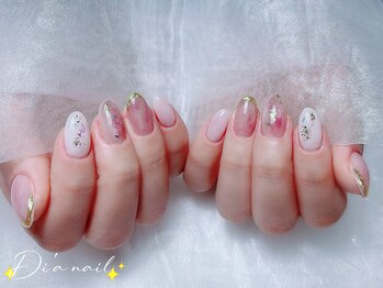 定額/フィルイン/パラジェル