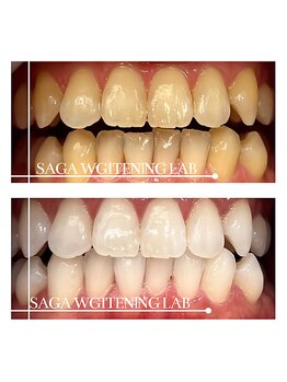 佐賀ホワイトニングラボ/