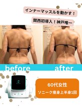 ボディデザインホームクレアフェリーチェ 神戸(Body design home Crea felice)/ソニーク痩身☆ビフォーアフター
