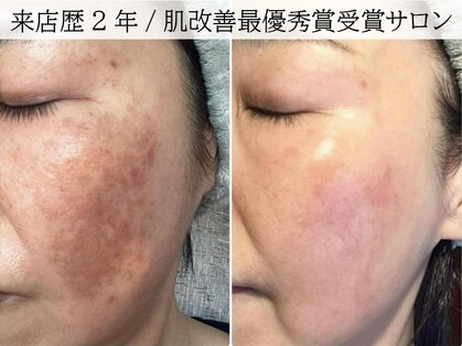 ラグランシエル(Le grand ciel)の写真