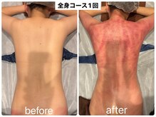 スピード美人 銀座店の雰囲気(食事制限なし!運動なし!痛みあり!★痩身スライドカッピング)