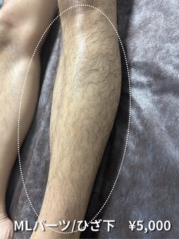 カナウ(KANAU)/【LLパーツ/脱毛】ひざ下