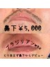 【男の口髭脱毛】鼻下、ヒゲのポツポツ、青ひげ無くしたい方￥5,000