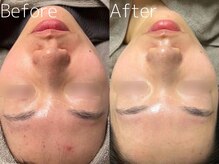 マイナプラ 表参道(myna+)/