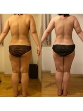 ラクーン 武蔵小杉(raccoon)/レッグスリム・ヒップアップ♪