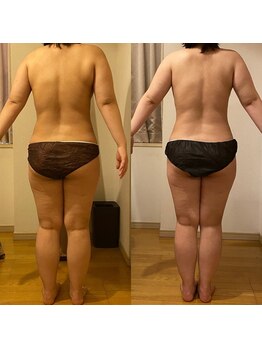 ラクーン 武蔵小杉(raccoon)/レッグスリム・ヒップアップ♪