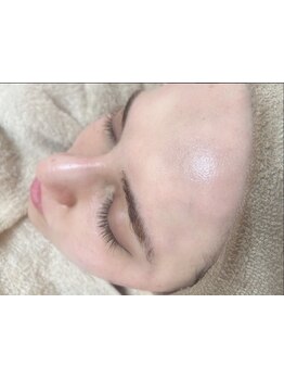 ハリツヤをUPしたい