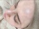 ルシアル(Rucial)の写真/［明石/魚住］白玉ワックスでちゅるちゅる水光肌へ☆大人気ハーブピーリングとのセットやブライダルにも◎