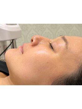 小顔になりたい