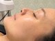 ドクターエイチ 大阪本町店(Doctor.H)の写真/【最先端美容液導入×幹細胞美容液】大事な日やイベント前に最高の自分に♪ダウンタイムや痛みほぼなし！