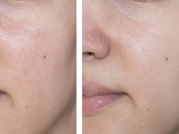 マリヴェリーテ(Mari verite)/もう隠さない、自信のある肌へ