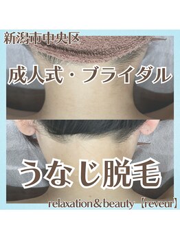 レヴール(reveur)/うなじ脱毛[美容脱毛/新潟脱毛]