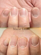 マリーロール 淀屋橋本店(Marie Laure)/深爪矯正/自爪育成/ネイルケア