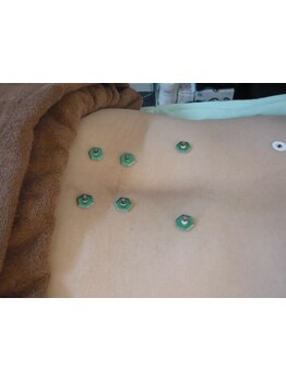 腰のつらさを改善したい