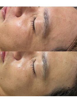 ヨルエステ(yoru aesthe)/【エイジング、シミケア】