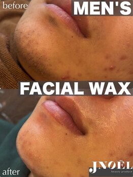 ジェノール 2nd beauty studio 姫路駅前店(JNOEL)/清潔感◎メンズフェイシャルWax