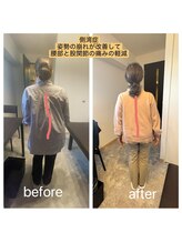 アンティオール 古河店/骨盤、体の歪みに！【古河整体】