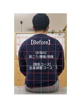 おざき整体院/頭痛/肩こり/腰痛/全身調整