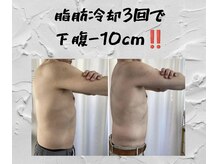 プレズィール(Plaisir)