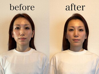 ヴィヴ(Vive)/ドライヘッドスパ60分のお客様