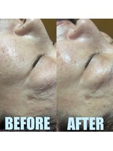 エルミオ エスパシオ ミロク(El mio espacio 369miroku)/AROMA BODY×CARBOXY FACIAL★