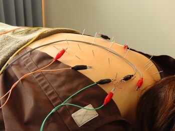 桜上水駅南整体院/鍼パルス(電気)