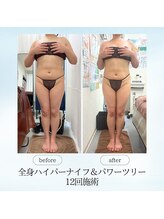 エスプレッソ(espresso,)/しつこい脂肪もスッキリ♪