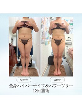 エスプレッソ(espresso,)/しつこい脂肪もスッキリ♪