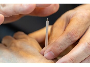 みわ整体鍼灸院の写真/資格保持者による鍼灸施術で慢性的な痛みや不調を改善◎ストレスや緊張をほぐし体のバランスを整えましょう