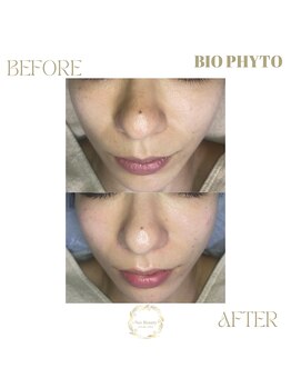 ネス 沖縄店(Nes.)/BIOPHYTO/ビオフィート